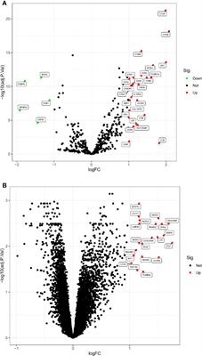 Predicting diagnostic gene expression profiles associated with immune infiltration in patients with lupus nephritis